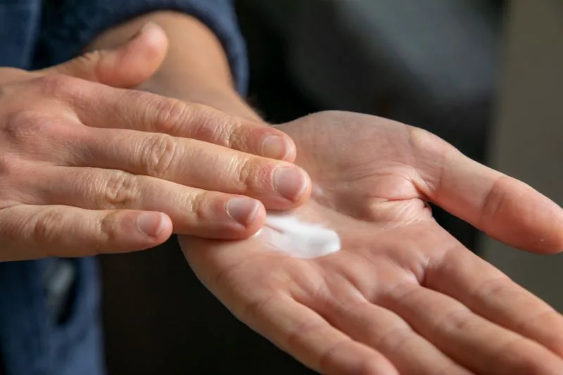 A blob of thick white cream resting in the palm of a hand